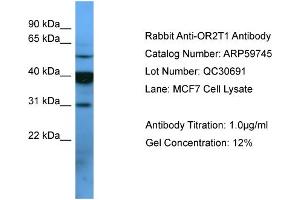 WB Suggested Anti-OR2T1  Antibody Titration: 0. (OR2T1 anticorps  (C-Term))