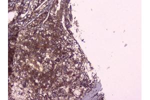 IHC analysis of PBP using anti-PBP antibody (ABIN5693043).