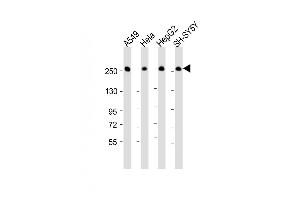 All lanes : Anti-FASN Antibody (Center) at 1:16000 dilution Lane 1: A549 whole cell lysate Lane 2: Hela whole cell lysate Lane 3: HepG2 whole cell lysate Lane 4: SH-SY5Y whole cell lysate Lysates/proteins at 20 μg per lane.