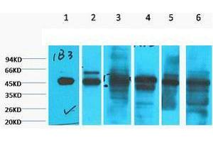 Western Blot (WB) analysis of 1) HepG2, 2) HeLa, 3) Mouse Liver tissue, 4) C2C12, 5) Rat Heart tissue, 6) Mouse Skeletal Muscle tissue, diluted at 1:2000. (Cytokeratin 18 anticorps)
