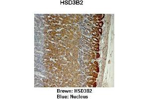 Sample Type :  Monkey adrenal gland   Primary Antibody Dilution :   1:25   Secondary Antibody:  Anti-rabbit-HRP   Secondary Antibody Dilution:   1:1000   Color/Signal Descriptions:  Brown: HSD3B2 Blue: Nucleus   Gene Name:  HSD3B2   Submitted by:  Jonathan Bertin, Endoceutics Inc. (HSD3B2 anticorps  (N-Term))
