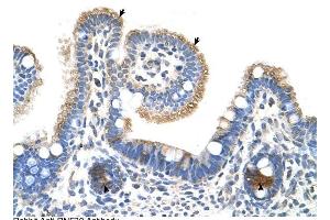 RNF39 antibody was used for immunohistochemistry at a concentration of 4-8 ug/ml to stain Epithelial cells of intestinal villus (arrows) and intestinal gland (arrows Heads) in Human Intestine.