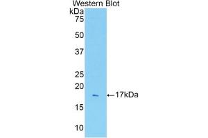 Detection of Recombinant IL1R1, Rat using Polyclonal Antibody to Interleukin 1 Receptor Type I (IL1R1)