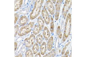 Immunohistochemistry of paraffin-embedded mouse kidney using THUMPD3 Rabbit pAb (ABIN6132951, ABIN6149133, ABIN6149134 and ABIN6214652) at dilution of 1:200 (40x lens). (THUMPD3 anticorps  (AA 1-250))