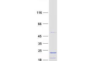 Validation with Western Blot
