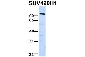 Host:  Rabbit  Target Name:  FAM46C  Sample Type:  Human Fetal Liver  Antibody Dilution:  1.