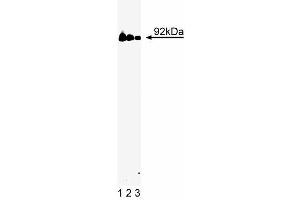 Western blot analysis of Stat3 on a A431 cell lysate (Human epithelial carcinoma, ATCC CRL-1555). (STAT3 anticorps  (AA 1-175))