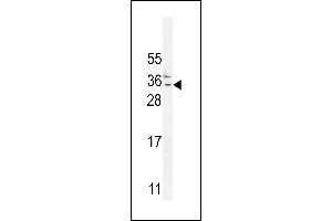C Antibody (N-term) (ABIN654735 and ABIN2844423) western blot analysis in MDA-M cell line lysates (35 μg/lane). (C11orf73 anticorps  (N-Term))