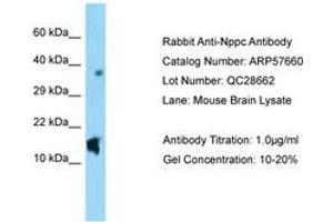 Image no. 1 for anti-Natriuretic Peptide Type C (NPPC) (AA 71-120) antibody (ABIN6749943) (NPPC anticorps  (AA 71-120))