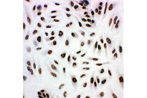 Anti-HDAC3 antibody,  ICC ICC: A549 Cell