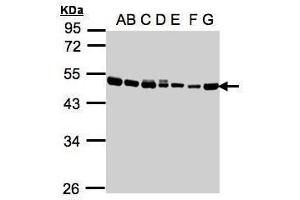 WB Image Sample(30μg whole cell lysate) A: 293T B: A431 , C: H1299 D: HeLa S3 , E: Hep G2 , F: MOLT4 , G: Raji , 10% SDS PAGE antibody diluted at 1:1000 (EEF1A2 anticorps)