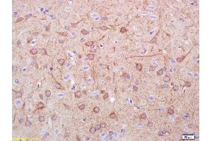 Formalin-fixed and paraffin embedded rat brain labeled with Rabbit Anti DDC/DOPA Decarboxylase Polyclonal Antibody, Unconjugated (ABIN725945) at 1:200 followed by conjugation to the secondary antibody and DAB staining