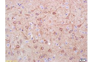 Formalin-fixed and paraffin embedded rat brain labeled with Rabbit Anti DDC/DOPA Decarboxylase Polyclonal Antibody, Unconjugated (ABIN725945) at 1:200 followed by conjugation to the secondary antibody and DAB staining (DDC anticorps  (AA 201-300))