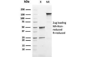 SDS-PAGE Analysis of Purified Perforin-1 Mouse Monoclonal Antibody (PRF1/2468).