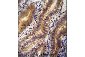 ANGPT2 antibody (C-term) (ABIN654062 and ABIN2843960) immunohistochemistry analysis in formalin fixed and paraffin embedded human uterus tissue followed by peroxidase conjugation of the secondary antibody and DAB staining.