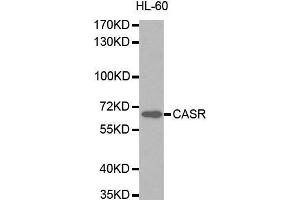 Western blot analysis of extracts of HL-60 cells lines, using CASR antibody. (CASR anticorps  (AA 874-1088))