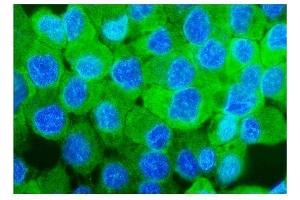 IF analysis of Sorbitol Dehydrogenase/ SORD using anti-Sorbitol Dehydrogenase/ SORD antibody (ABIN7602486).