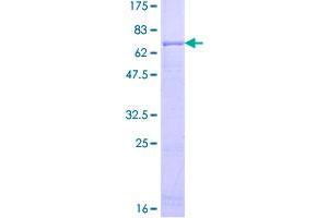 Image no. 1 for Acyl-CoA Dehydrogenase, Short/branched Chain (ACADSB) (AA 1-432) protein (GST tag) (ABIN1305593)