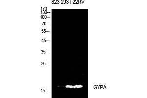 Western Blot (WB) analysis of 823, 293T, 22RV cells using CD235a Polyclonal Antibody. (CD235a/GYPA anticorps  (Internal Region))