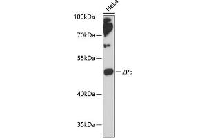 Western blot analysis of extracts of HeLa cells, using ZP3 antibody (ABIN6134464, ABIN6150536, ABIN6150538 and ABIN6217045) at 1:3000 dilution. (Zona Pellucida Glycoprotein 3 anticorps  (AA 250-350))