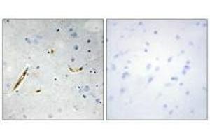 Immunohistochemistry analysis of paraffin-embedded human brain tissue using TCF3 antibody.
