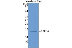 Western Blotting (WB) image for anti-Interleukin 6 Receptor (IL6R) (AA 214-348) antibody (ABIN3206014) (IL-6 Receptor anticorps  (AA 214-348))