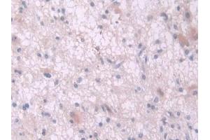 anti-Interleukin 2 (IL2) (AA 21-153) antibody