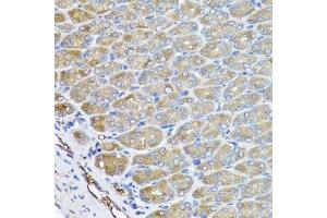 Immunohistochemistry of paraffin-embedded mouse stomach using VPS37A antibody. (VPS37A anticorps  (AA 224-397))