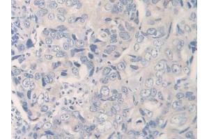 Used in DAB staining on fromalin fixed paraffin- embedded kidney tissue (IL12A anticorps  (AA 23-219))