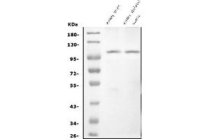 Western blot analysis of CARD4/NOD1 using anti-CARD4/NOD1 antibody (ABIN7602813).