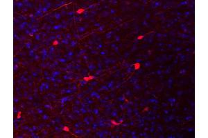 Indirect immunolabeling of a PFA fixed mouse coretex section (dilution 1 : 500; red).