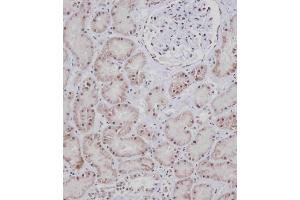 Immunohistochemical analysis of E on paraffin-embedded Human kidney tissue. (BRAF anticorps  (AA 379-408))