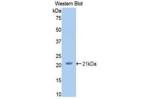 Western Blotting (WB) image for anti-Complement Factor P (CFP) (AA 54-217) antibody (ABIN3207870) (CFP anticorps  (AA 54-217))