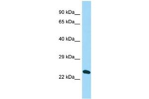 Host: Rabbit Target Name: C16orf53 Sample Type: Hela Whole cell lysates Antibody Dilution: 1. (PAGR1 anticorps  (N-Term))