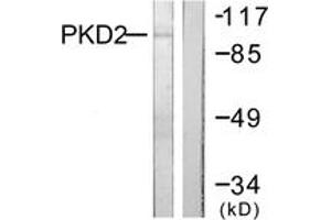 Western blot analysis of extracts from NIH-3T3 cells, treated with PMA 250ng/ml 15', using PKD2 (Ab-876) Antibody. (PKD2 anticorps  (AA 829-878))