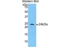 Western Blotting (WB) image for anti-Toll-Like Receptor 5 (TLR5) (AA 46-205) antibody (ABIN1175326) (TLR5 anticorps  (AA 46-205))