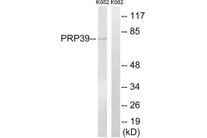 Western blot analysis of extracts from K562 cells, using PRPF39 antibody. (PRPF39 anticorps  (Internal Region))