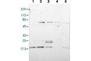 Western blot analysis of Lane 1: RT-4, Lane 2: U-251 MG, Lane 3: A-431, Lane 4: Liver, Lane 5: Tonsil with ATF3 polyclonal antibody  at 1:100-1:250 dilution. (ATF3 anticorps)