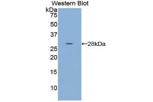 Western blot analysis of the recombinant protein. (WARS anticorps  (AA 140-347))