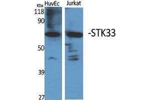 Western Blot (WB) analysis of specific cells using STK33 Polyclonal Antibody. (STK33 anticorps  (N-Term))
