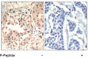 Image no. 2 for anti-Cyclin-Dependent Kinase 6 (CDK6) (pTyr13) antibody (ABIN401597) (CDK6 anticorps  (pTyr13))