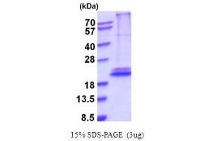 SDS-PAGE (SDS) image for Interleukin 28B (Interferon, lambda 3) (IL28B) (AA 22-196) protein (His tag) (ABIN5854225)