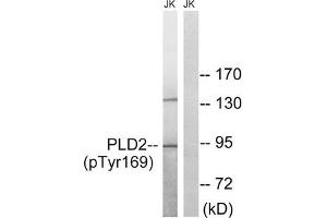 Western blot analysis of extracts from Jurkat cells treated with TNF using PLD2 (Phospho-Tyr169) Antibody. (Phospholipase D2 anticorps  (pTyr169))