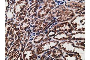 Immunohistochemical staining of paraffin-embedded Human Kidney tissue using anti-LMAN1 mouse monoclonal antibody. (LMAN1 anticorps)