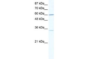 WB Suggested Anti-ZNF668 Antibody Titration:  0. (ZNF668 anticorps  (N-Term))