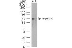 Image no. 1 for anti-SARS-Coronavirus Spike Protein (SARS-CoV S) (AA 288-303) antibody (ABIN199981) (SARS-CoV Spike anticorps  (AA 288-303))