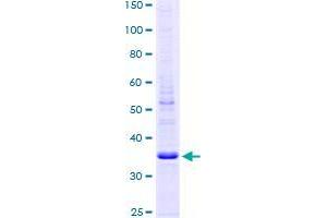 Image no. 1 for Dexamethasone-Induced Transcript (DEXI) (AA 1-95) protein (GST tag) (ABIN1351475)