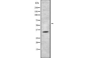 Western blot analysis of MAGG1 using 293 whole cell lysates