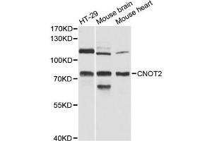 Western blot analysis of extracts of various cell lines, using CNOT2 antibody (ABIN6290147) at 1:3000 dilution. (CNOT2 anticorps)