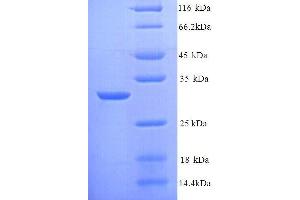 Enoyl-ACP Reductase (INHA) (AA 1-269), (full length) protein (His tag) (INHA Protein (AA 1-269, full length) (His tag))